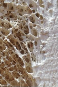 Tejido óseo compacto y esponjoso