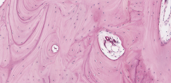 Matriz ósea: Principales componentes estructurales