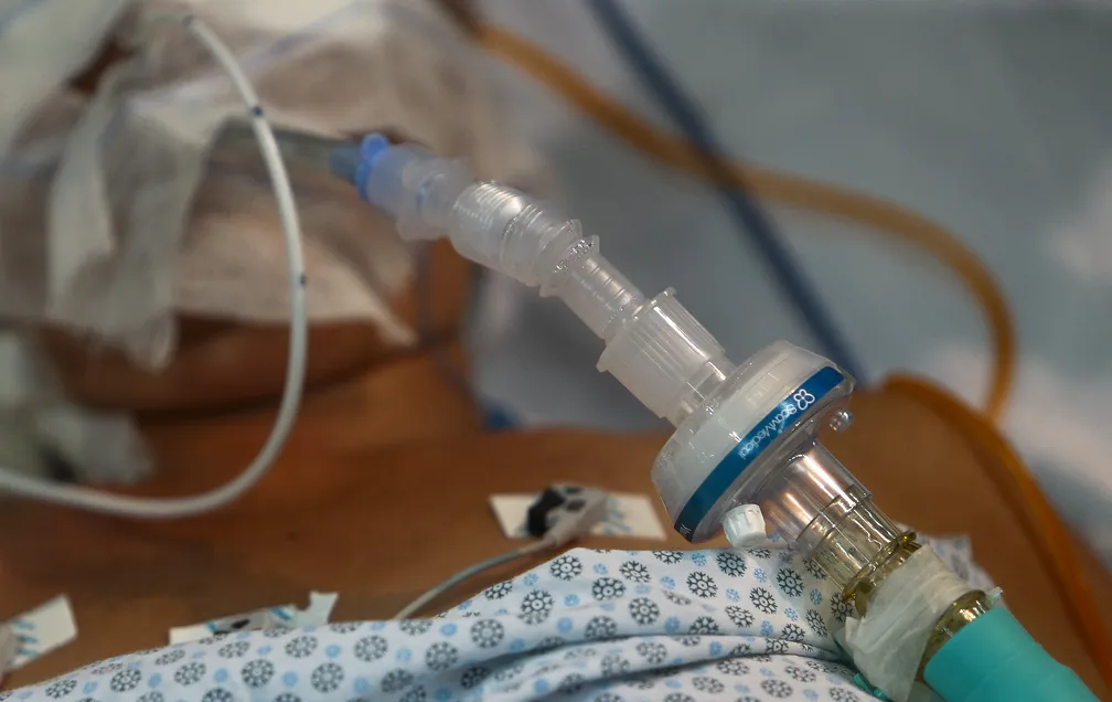 Complicaciones de la intubación endotraqueal