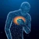 ¿Qué es el síndrome coronario agudo?