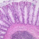 Capas de la pared del intestino grueso