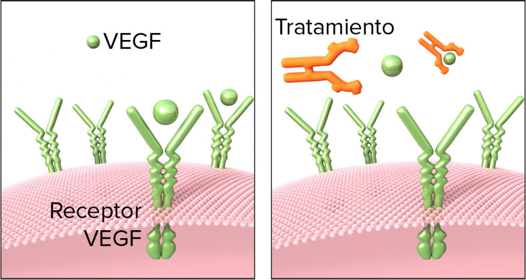 Agentes farmacológicos bloqueadores del VEGF