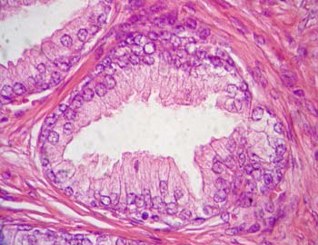 Histología de la Próstata