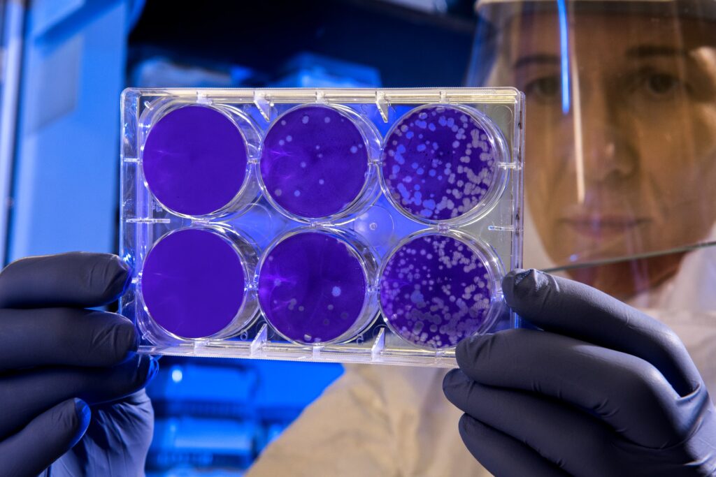 Transplante de células madre pluripotenciales inducidas