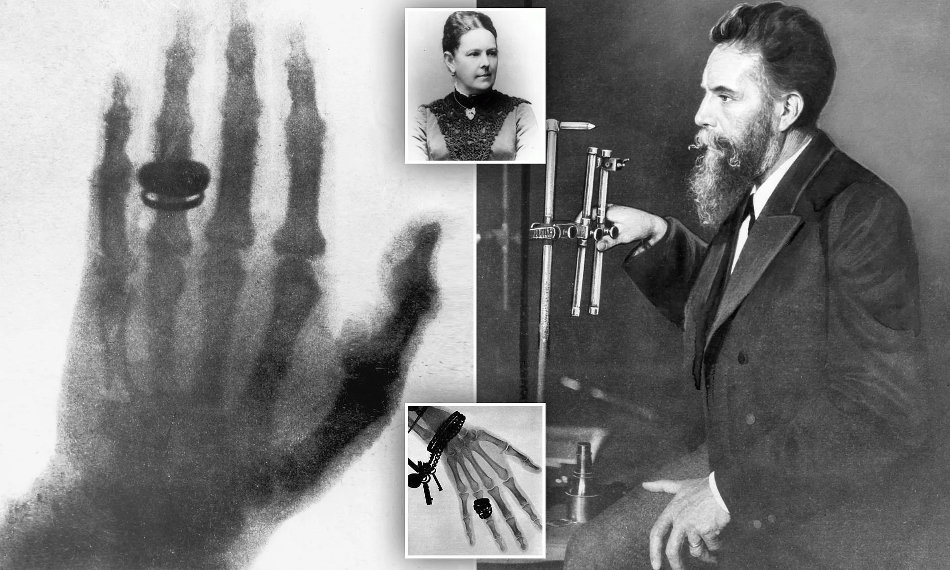 ¿Cuál fue la aportación de Wilhelm Röntgen a la medicina?