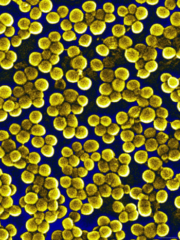 ¿Qué causan las toxinas de Staphylococcus aureus?