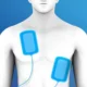 ¿Cuáles son las modalidades para cardioversión electiva?