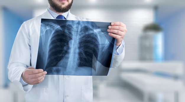 Auxiliares diagnósticos para detectar neumonía