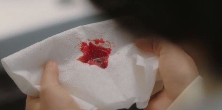 Hallazgos clínicos en pacientes con hemoptisis