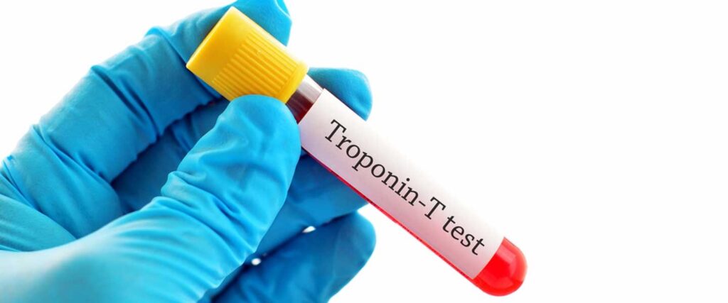 Troponinas para la evaluación de pacientes con disnea