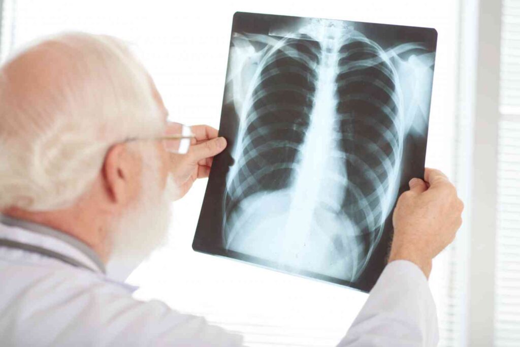 Radiografía de tórax en pacientes con dolor torácico