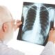 Radiografía de tórax en pacientes con dolor torácico