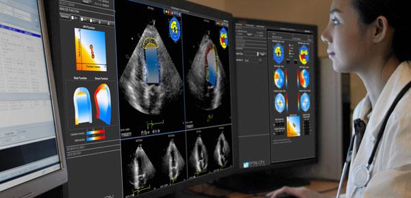 Ecocardiografía de estrés en pacientes con dolor torácico