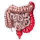 ¿Qué es la colitis ulcerativa?