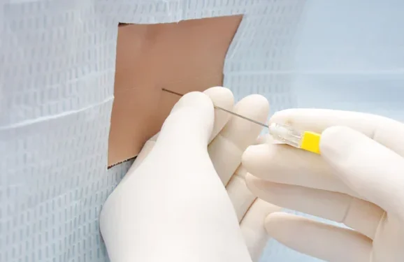 Punción lumbar en pacientes con cefalea