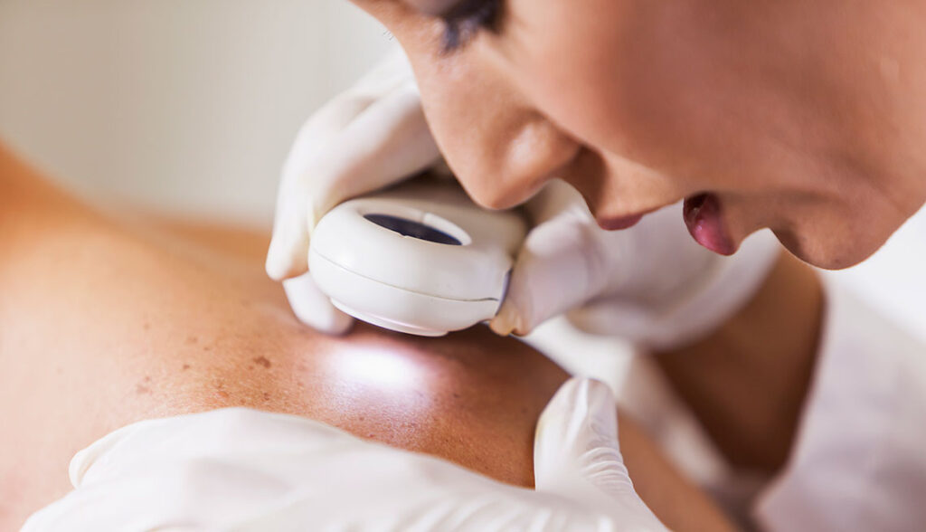 Bases para el diagnóstico de las enfermedades dermatológicas