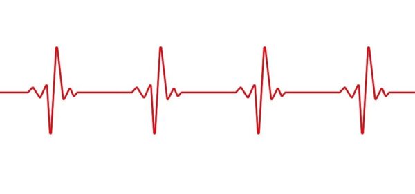 ¿Qué es el trazado del electrocardiograma?