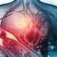 Enfermedades cardiovasculares, problemas de salud pública