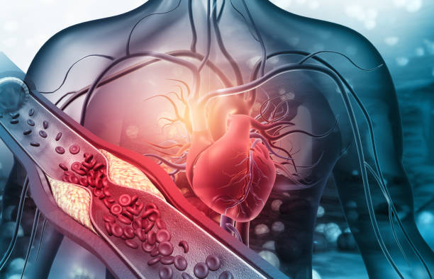 Enfermedades cardiovasculares, problemas de salud pública