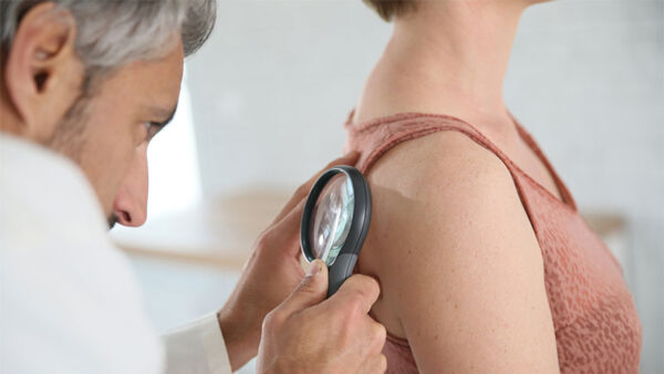 Características de las lesiones sospechosas de melanoma
