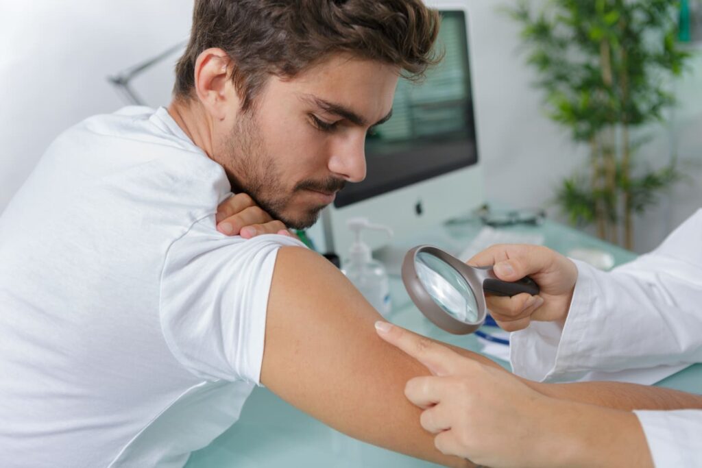 Riesgo de padecer melanoma