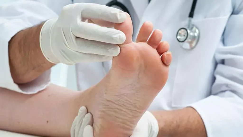 Diagnóstico diferencial de la tiña de manos y pies