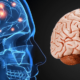 Reacciones de las neuronas a la lesión
