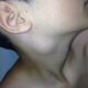 Las adenopatias cervicales indican cancer o infección