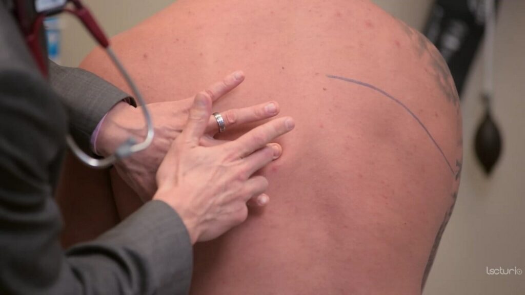 Matidez pulmonar en pacientes con derrame