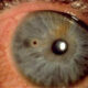 cuerpo extraño intraocular