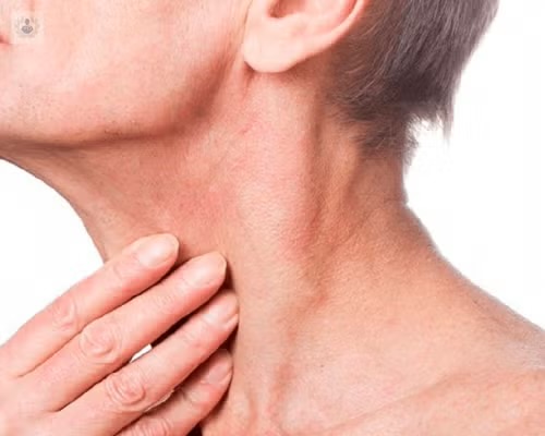 Diagnósticos probables en pacientes con masas del cuello