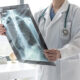Causas de la Enfermedad Pulmonar Obstructiva Crónica