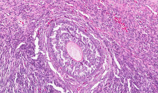 Histología de ovario