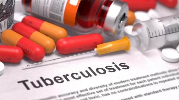 Tratamiento de la tuberculosis resistente a los medicamentos