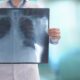 Neumonitis por radiación