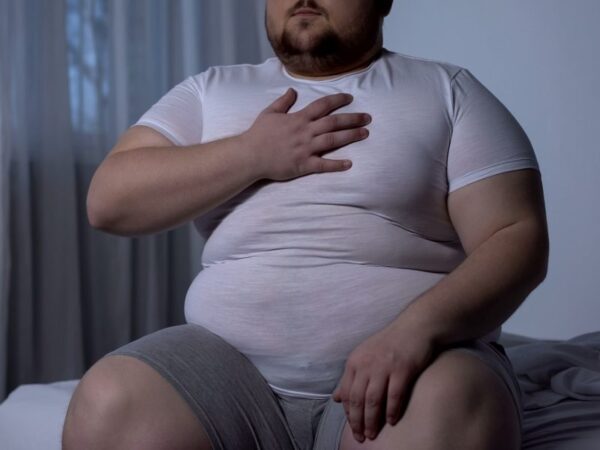 SÍNDROME DE OBESIDAD-HIPOVENTILACIÓN (Síndrome de Pickwick)