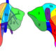 Segmentación hepática