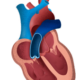 Regurgitación de la válvula pulmonar