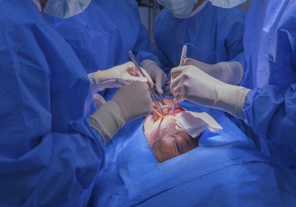 Tratamiento de la regurgitación mitral secundaria