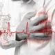 Trombosis Mural en pacientes con infarto al miocardio