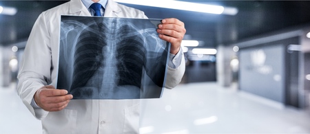 Insuficiencia cardíaca aguda y edema pulmonar