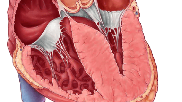 Definición de mocardiopatía hipertrófica