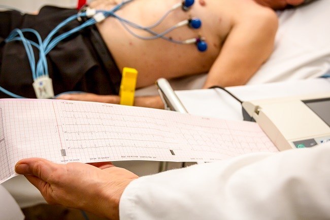 Estudios diagnósticos para miocardiopatía hipertrófica