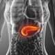 Conceptos clave de la pancreatitis aguda