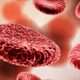 Anemia asociada a enfermedades crónicas