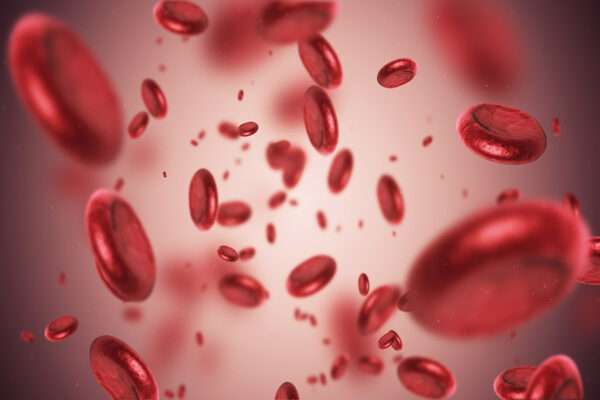 Anemia por deficiencia de hierro