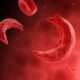 Anemia de células falciformes