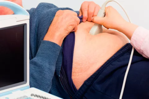 Diagnóstico de ascitis