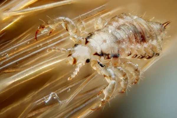 Tratamiento de la pediculosis