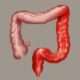 Diagnóstico de colitis ulcerativa